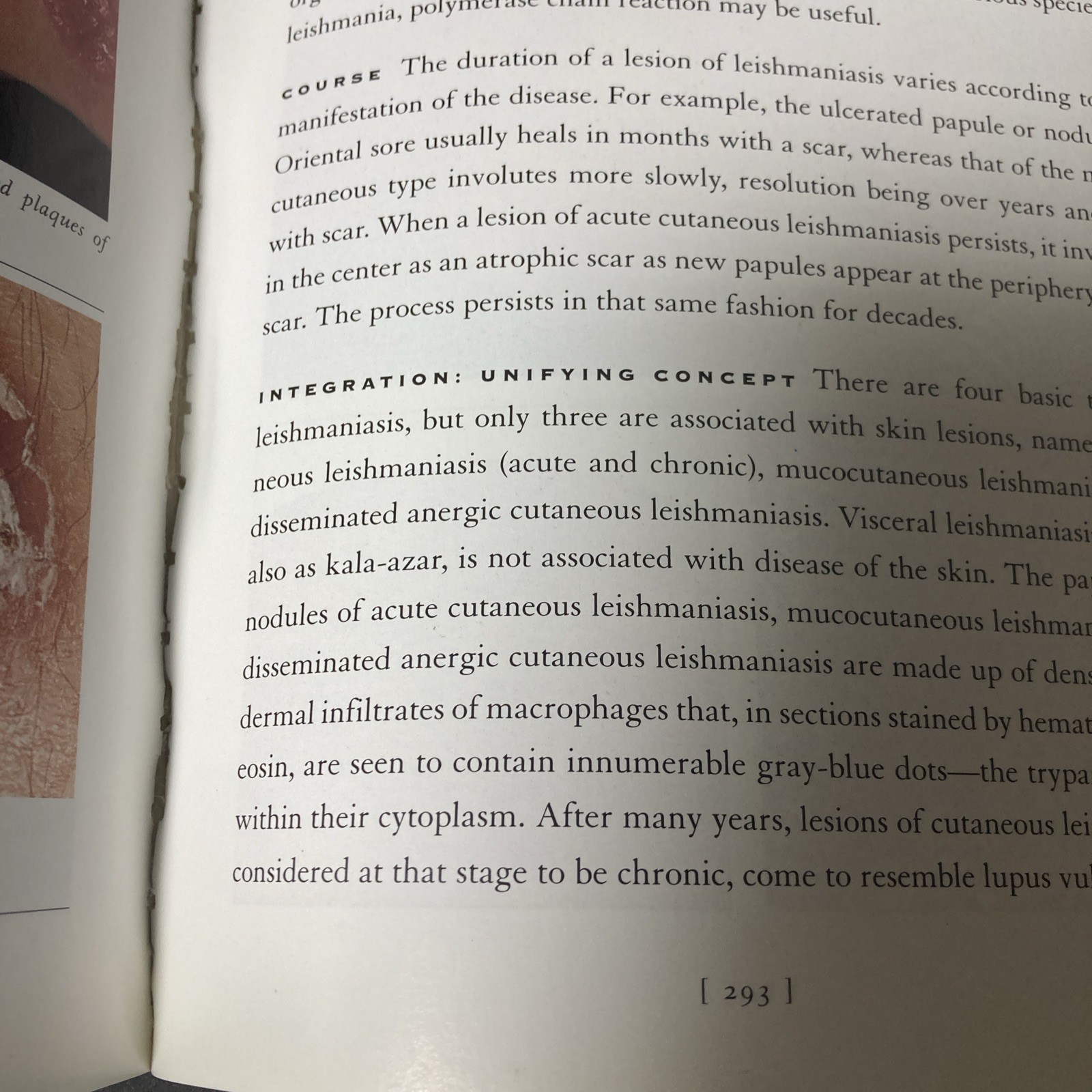 A Clinical Atlas of 101 Common Skin Diseases And Histopatholgic Correlation